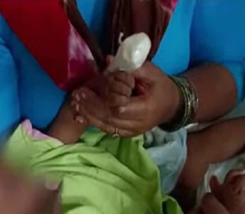 ಆಸ್ಪತ್ರೆಯಲ್ಲಿ ನರ್ಸ್ ಯಡವಟ್ಟು: 6 ತಿಂಗಳ ಮಗುವಿನ ಬೆರಳು ಕಟ್..!