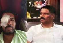 ಮುಖ್ಯಪೇದೆ ಹಲ್ಲೆ, ಕಣ್ಣಿನ ದೃಷ್ಠಿ ಕಳೆದುಕೊಂಡ ವ್ಯಕ್ತಿ: ಇನ್ನೂ ಪ್ರಕರಣ ದಾಖಲಿಸದ ಪೊಲೀಸರು