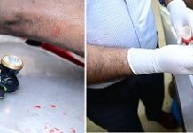 ಹನೂರು ಕೊಲೆ ಪ್ರಕರಣ: ಅತ್ಯಂತ ಸಮೀಪವೇ ಗುಂಡು ಹಾರಿಸಿ ಎನ್ ಕೌಂಟರ್ ಮಾಡಿರುವುದು ದೃಢ
